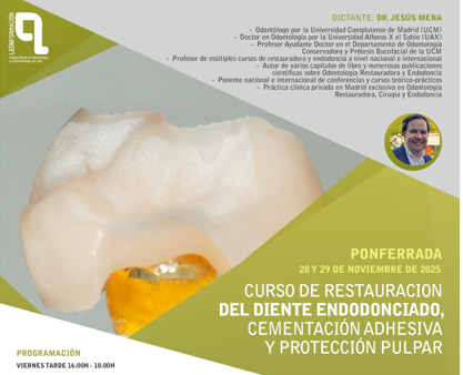 Curso de restauración del diente endodonciado con el Dr. Jesús Mena en Ponferrada